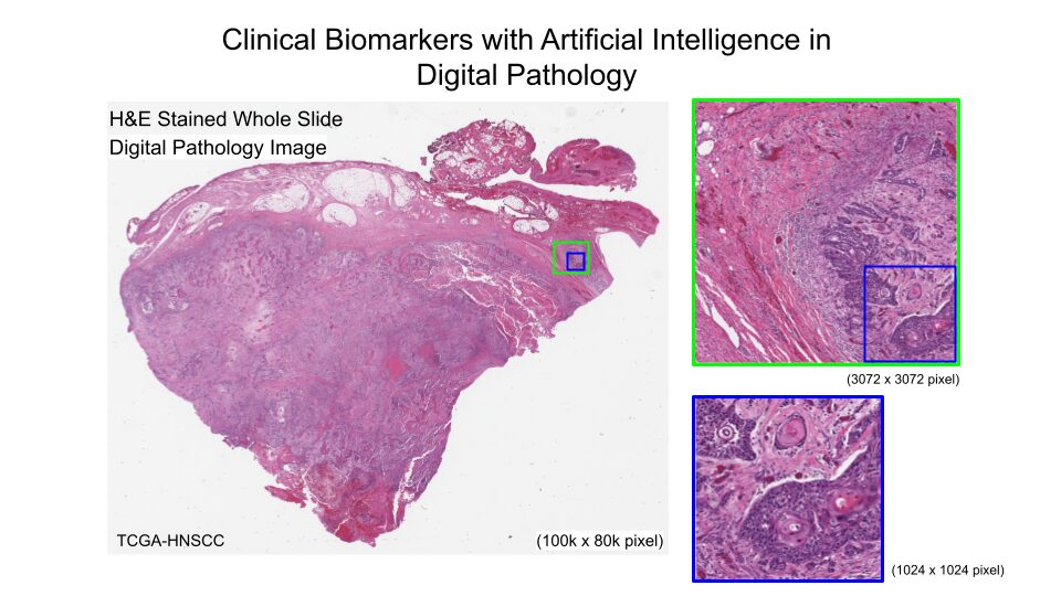 WSI pathology